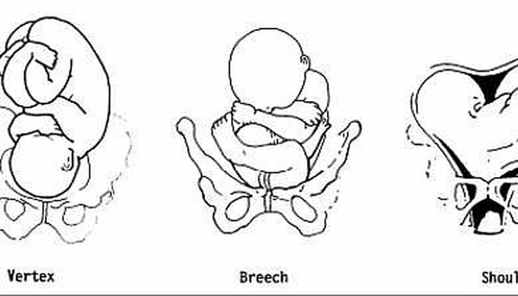 How to Understand Fetal Presentation | How To Adult