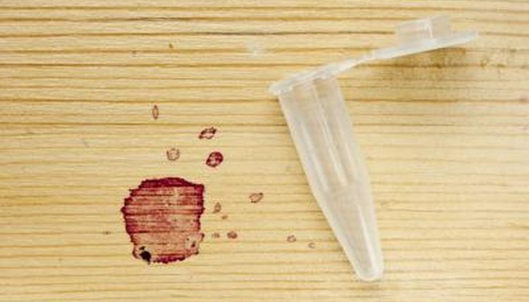 Blood splatter analysis.