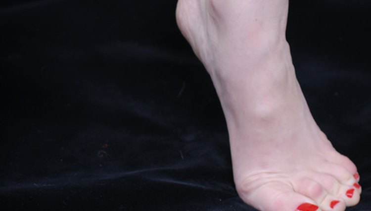 Plantar Fascia Rupture