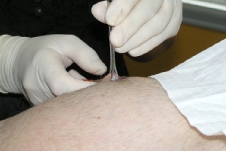 El piercing de pezón debe curarse como cualquier herida abierta.