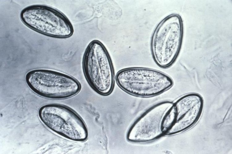 La oxiuriasis es el tipo más común de infección por gusanos redondos en los Estados Unidos.