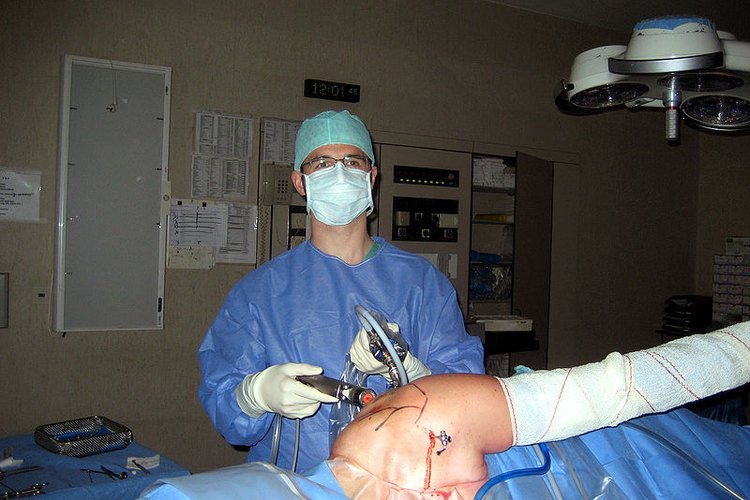 La cirugía de hombro artroscópica se realiza típicamente en las lesiones del manguito de los rotadores, tales como la tendinitis y los desgarres, algunos de los cuales pueden ser graves.