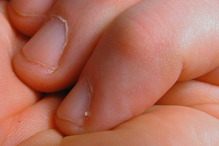 Para prevenir padrastros, usa crema hidratante sobre las manos, dedos y cutículas.
