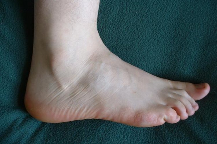 El mejor tratamiento para la neuropatía periférica en los pies.