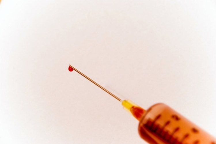 High creatinine levels may be a symptom of kidney failure.