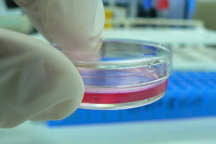 Los niveles de urea y creatinina se evalúan en un laboratorio.
