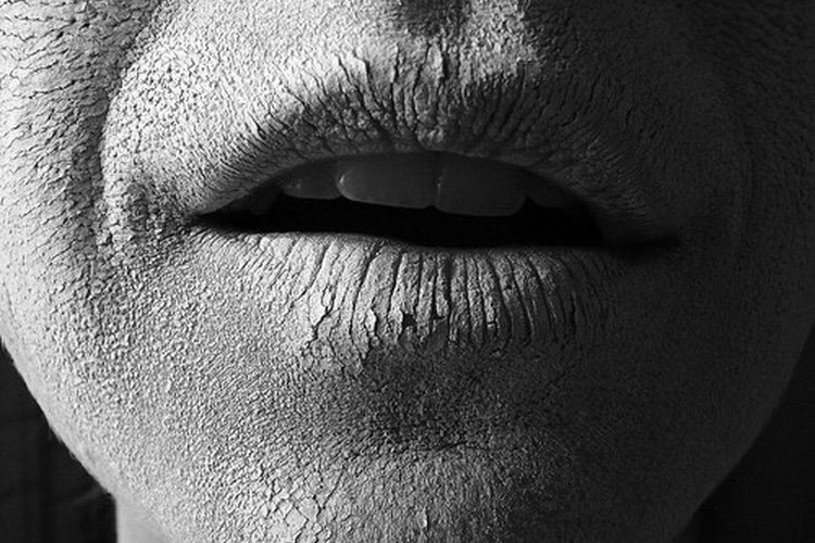 Picazón debido a la menopausia.