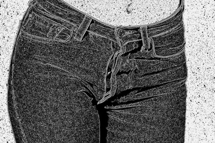 La bursitis de cadera se da cuando el saco sinovial se irrita o se inflama.