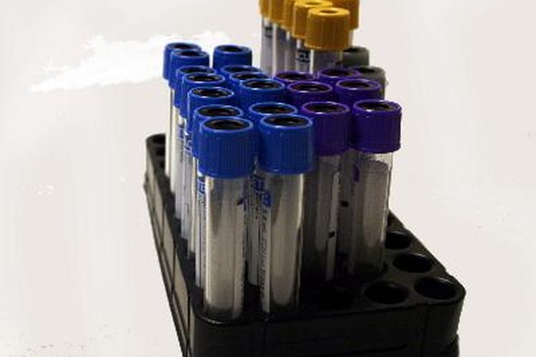 Una simple muestra de sangre, orina o saliva puede ser evaluada para determinar los niveles de estrógeno.