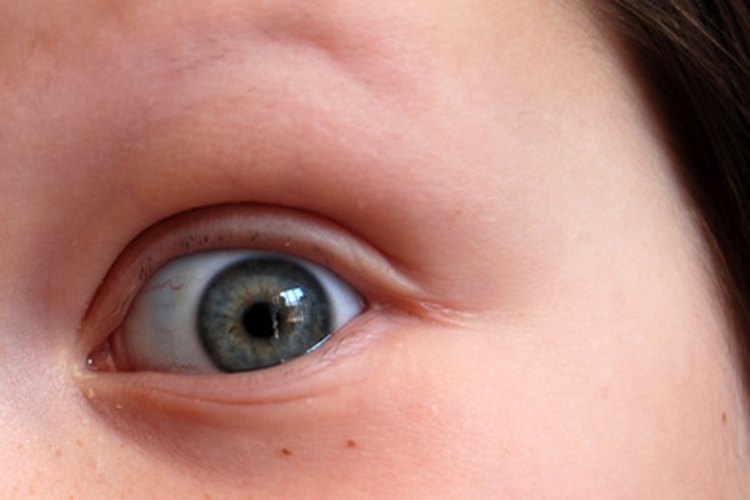 Muchas gotas son seguras para usar en los ojos de los niños.
