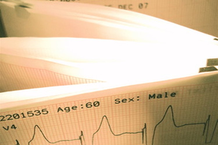 Los niveles de pH anormales pueden causar irregularidades en el latido cardiaco.
