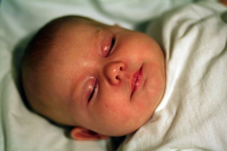 Los ojos hinchados en los bebés suelen aliviarse por sí solos.