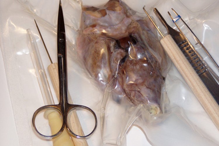 Tumor cerebral.