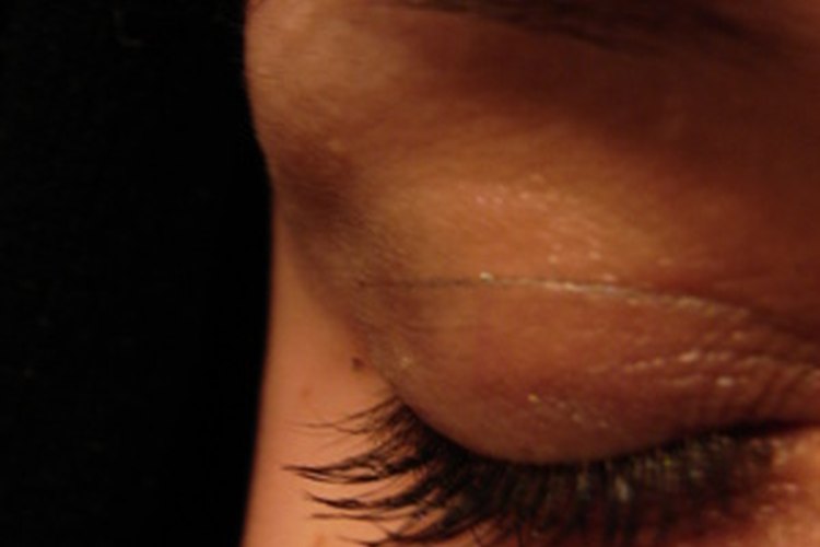La pérdida de cejas puede indicar desórdenes severos.
