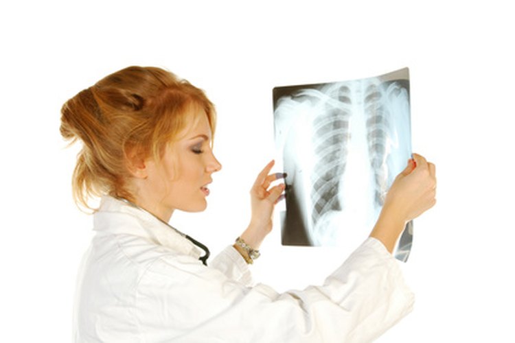 Los métodos para extraer el agua de los pulmones dependen de la forma en la que el agua entró a ellos.
