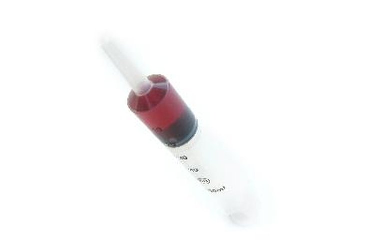 El tiempo transcurrido entre la fecha de la infección y cuando una prueba producirá un resultado positivo se llama el