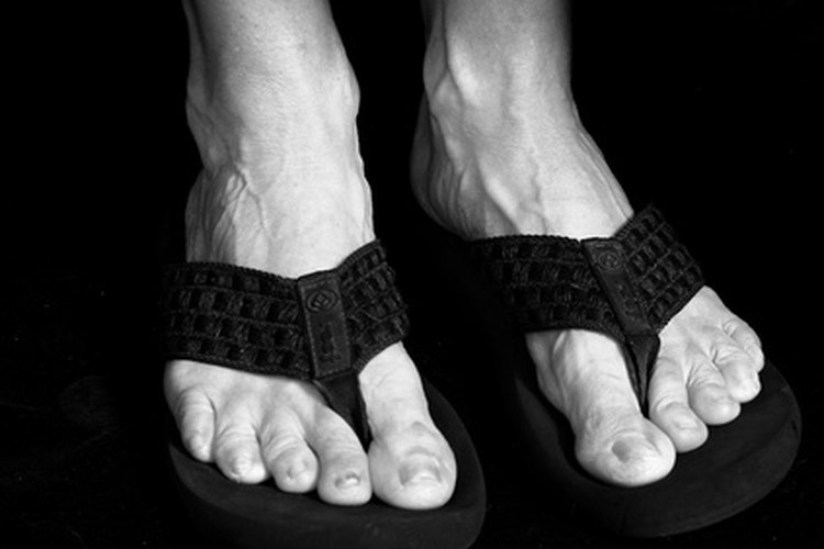 Los pies se hinchan por el calor como resultado de la acumulación del exceso de líquido.