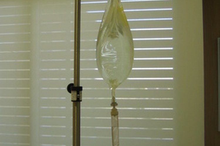 A veces, los pacientes con anemia ferropénica requieren de una terapia intravenosa de hierro.