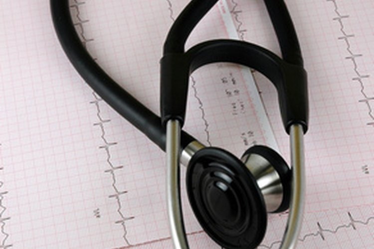 La ablación cardíaca es un procedimiento mínimamente invasivo a menudo usado para tratar la fibrilación auricular, aleteo auricular o taquicardia.