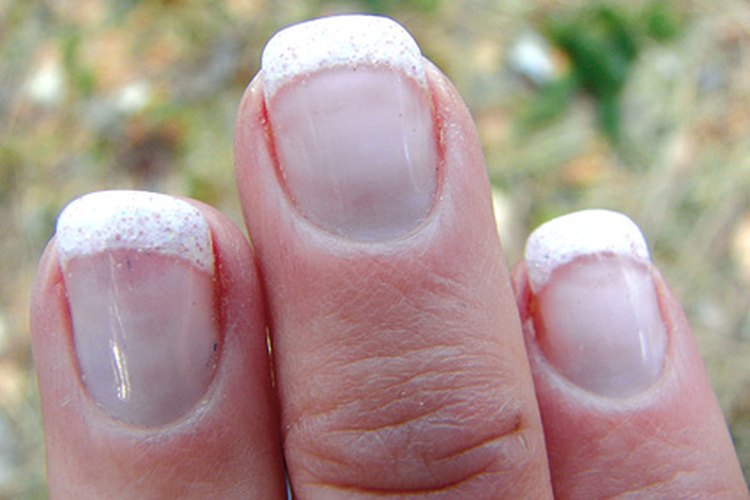 La infección de las uñas puede ser causada por zoonosis fúngica.