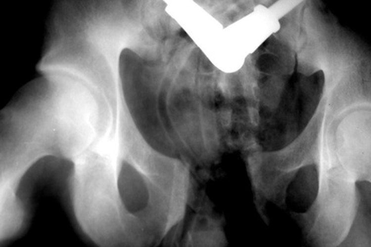 Ligamentos y músculos de la pelvis.