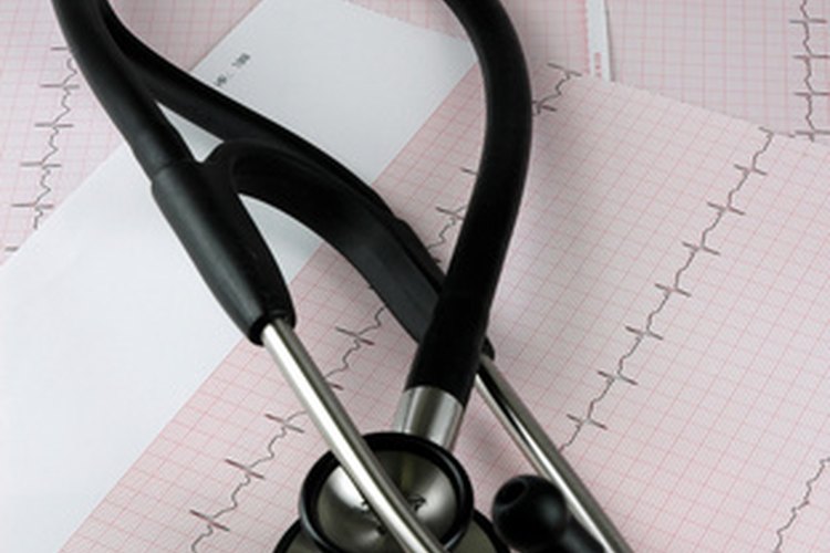 Una depresión de segmento ST es una anormalidad en el trazado EKG.
