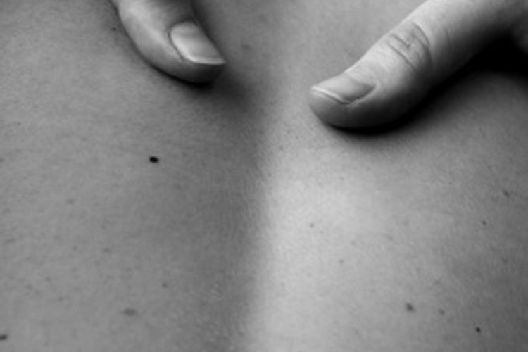 El alivio para los nudos de la fibromialgia está disponible.