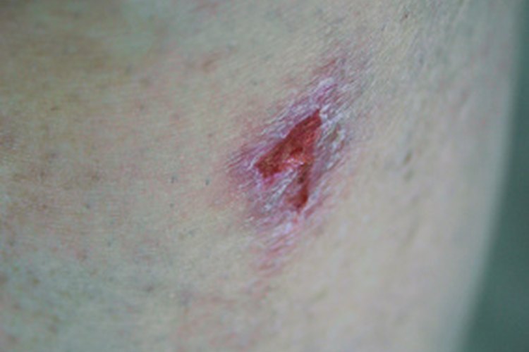 Herida de rata.