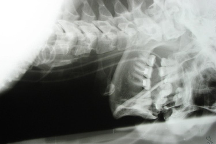 La glándula tiroides está localizada en la parte de tu cuello.
