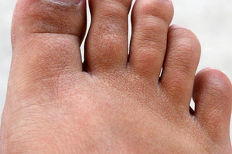 Los huesos, ligamentos y tendones pueden dañarse o inflamarse por el esfuerzo constante.