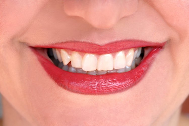 El agua carbonatada es relativamente buena para los dientes.