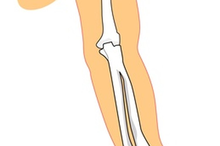 La tendinitis afecta los tendones, que conectan a los músculos con los huesos.