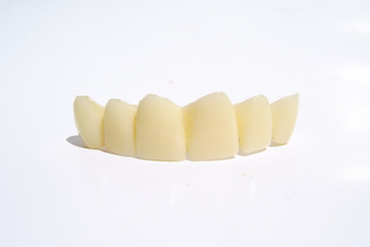 La higiene oral agresiva puede prevenir la formación de las manchas marrones en los dientes.