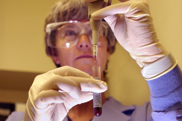 Tu médico mide los niveles de GGT con un análisis de sangre.
