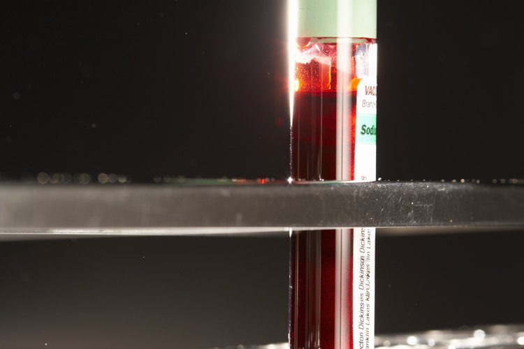 Niveles de potasio en sangre.
