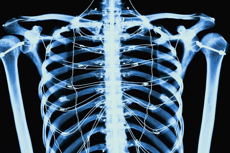 Hay varios tipos diferentes de quistes óseos y determinar qué tipo tienes exige un examen médico y pruebas diagnósticas.