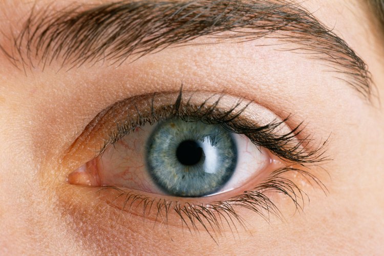 A pesar del nombre, la migraña ocular es indolora.