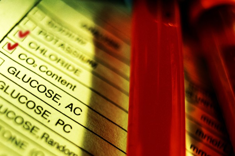 Existen diversos análisis de sangre que se utilizan para determinar el proceso de la menopausia.