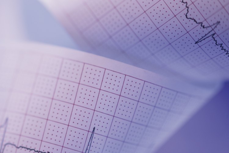La frecuencia cardíaca es una medida utilizada para evaluar tu salud cardiovascular.