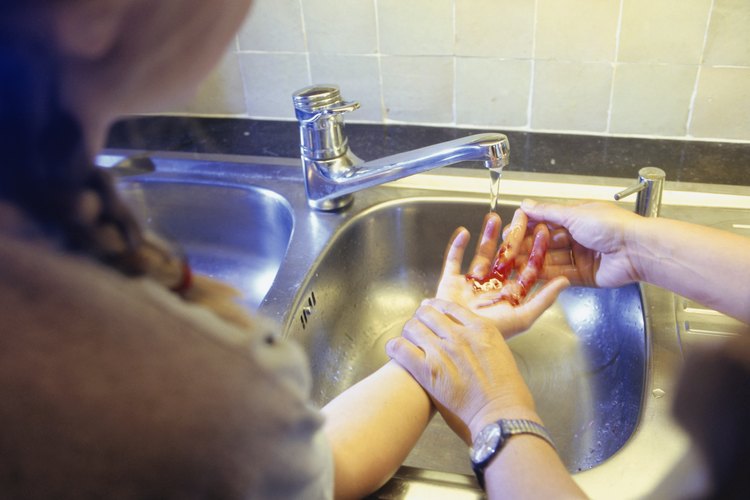 En caso de mordedura, debes lavar de inmediato la herida con agua y jabón.