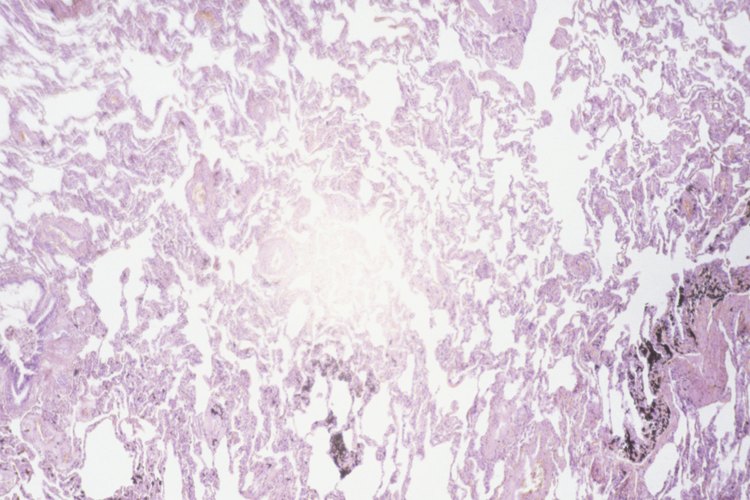 La proteína del suero puede no ser la mejor proteína para la función tiroidea, pero puede ser beneficiosa para las personas con cáncer de tiroides.