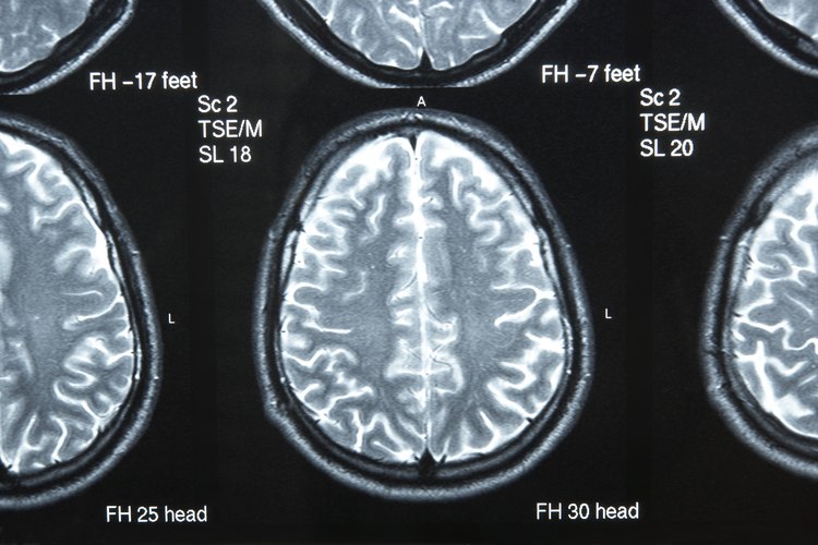 El cerebro es el órgano más importante en el cuerpo porque controla todas las funciones.