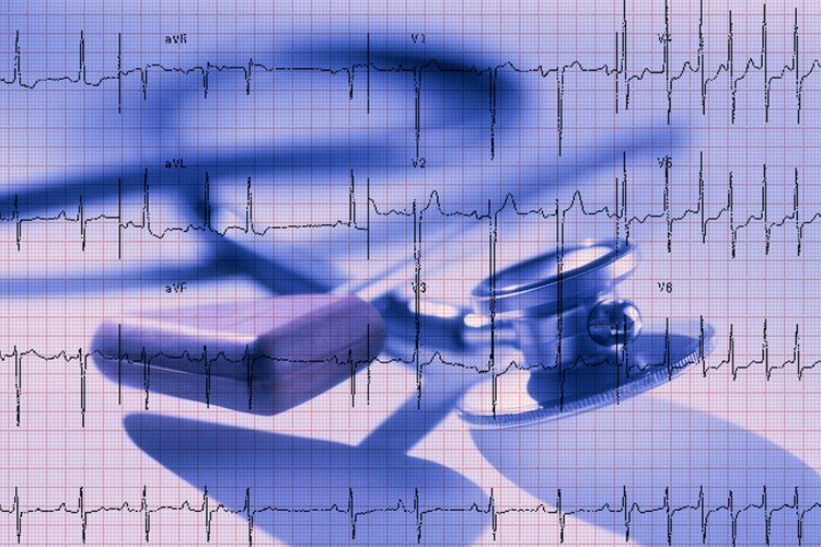 Algunos médicos ordenan un electrocardiograma como parte de un examen físico anual.