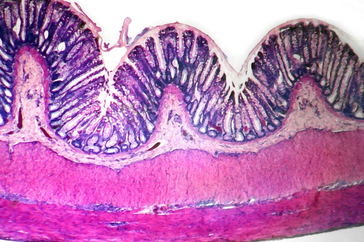 Las respuestas inapropiadas de los linfocitos intestinales pueden conducir a trastornos inflamatorios, tanto en el intestino delgado como en el grueso.