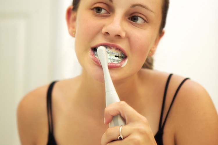 Enséñale a tus adolescentes que lavar sus retenedores es parte de la higiene oral.