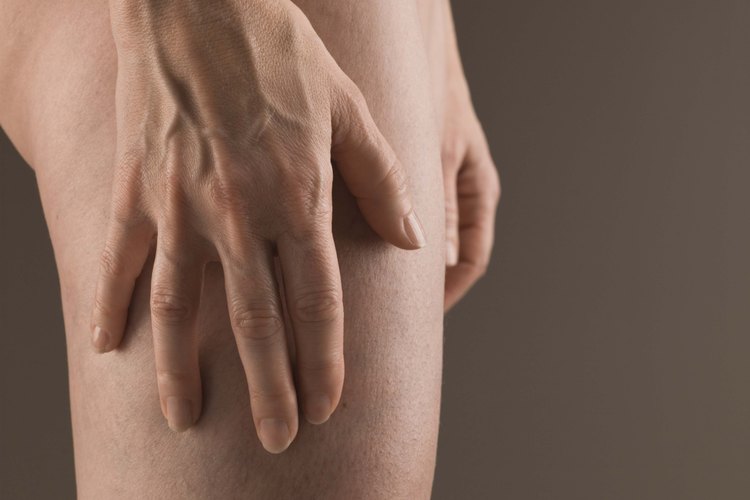 Los puntos negros pueden aparecer en cualquier lugar del cuerpo, como en los muslos.