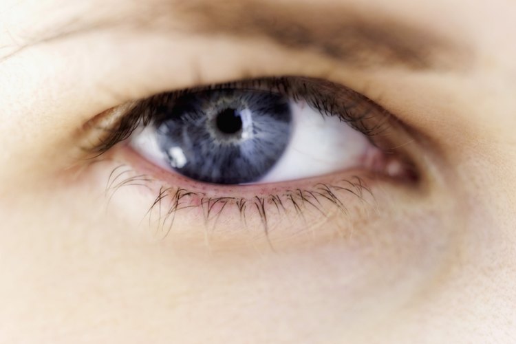 Desinfla las bolsas de debajo de tus ojos.