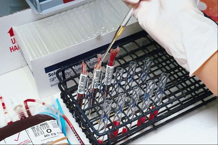 Calcular el colesterol es muy útil para llevar un control de tu sistema.