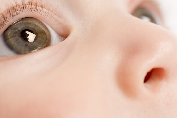 La conjuntivitis es común, contagiosa y por lo general se cura fácilmente.
