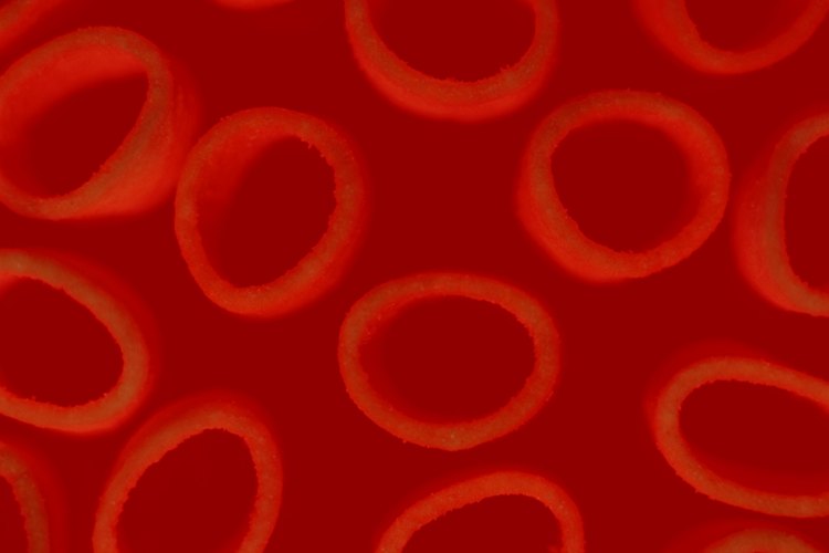 La anemia es una condición de la sangre.